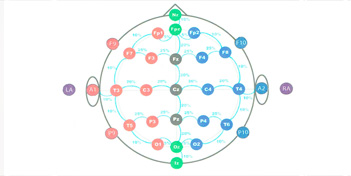 Elektrody używane w mikropolaryzacji